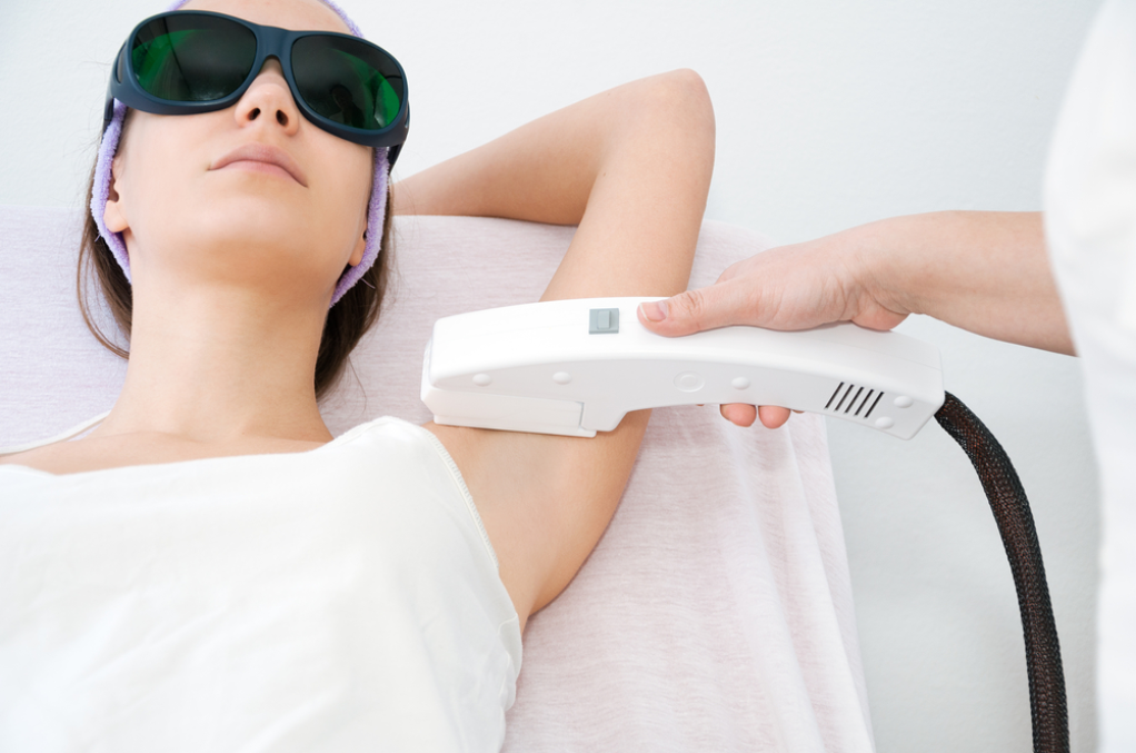 Epilation laser