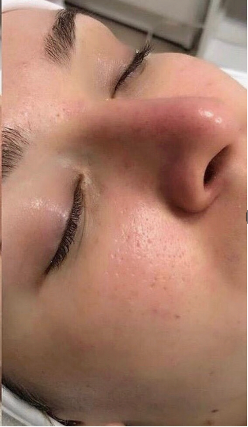 Soins Hydrafacial Centre Dakhla Agadir