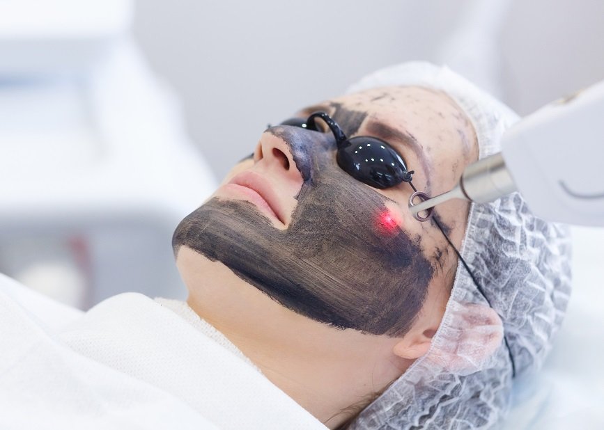 carbon peeling agadir centre dakhla